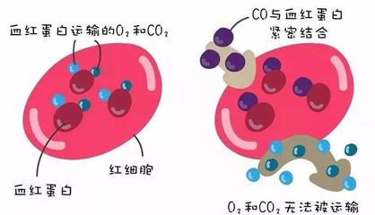 警惕洗澡季隱形殺手 一氧化碳中毒康復(fù)后，當(dāng)心遲發(fā)性腦病